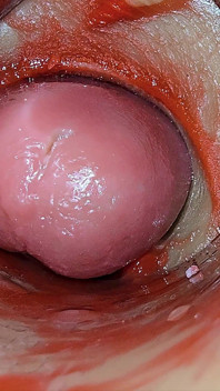 Kamera Uvnitř Hluboké Kundičky Zachycuje Předávkování Ejakulace Spermatu Asmr