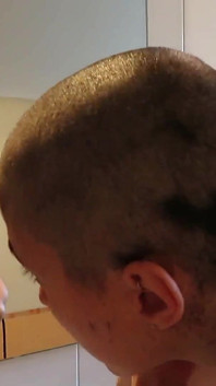 Italian Girl Shaves Her Head to Zero