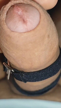 Electrical Pulsation Within the Glans with Rapid Excitation.