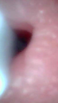 Endoscope Camera Captures Moment of Male Ejaculation 4K