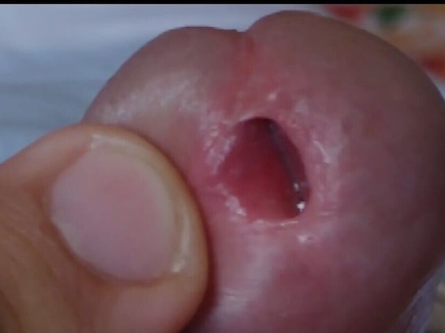 The Enlarged Glans Makes the Dick Stay Drooling and Erect for Longer. (Big Dick Red)