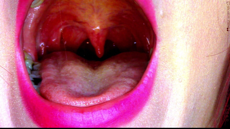 Scarlet Vixen: Sexy Scarlet Dice Ahhh - uvula showoff