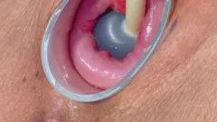 Inject Ink Deep Into My Uterus