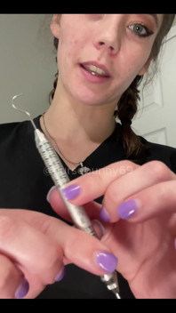 Sadistic Dental Cleaning
