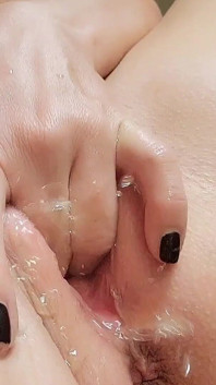 Squirt Care