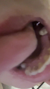 Mad for Tongue