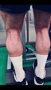 My Legs