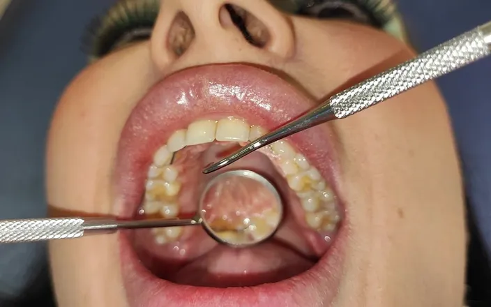 Princess18_: Complete Teeth Exam by the Dentist, Installation of Jewelry