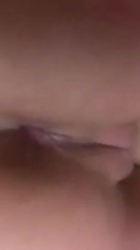 Kolonia anal