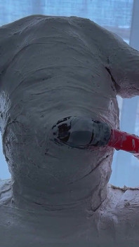 Hospital 3 - Full Body Cast
