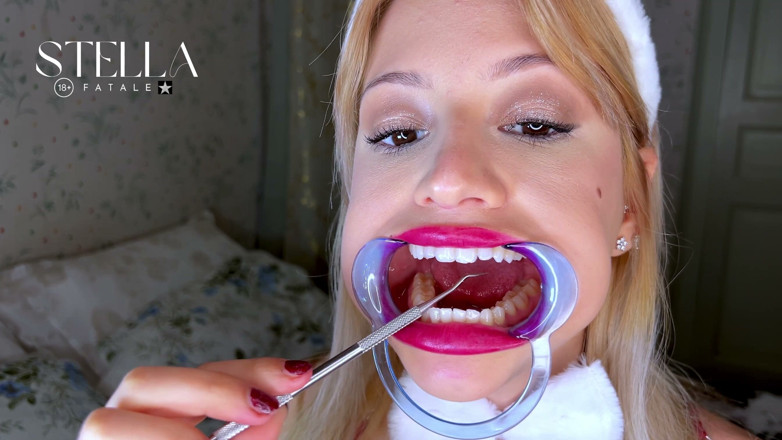 Stellafatale: Mouth Retractor Teeth Examination