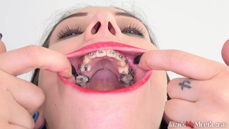 Inside My Mouth: Bara'nın diş teli gösterdiği ağız fetişi videosu.