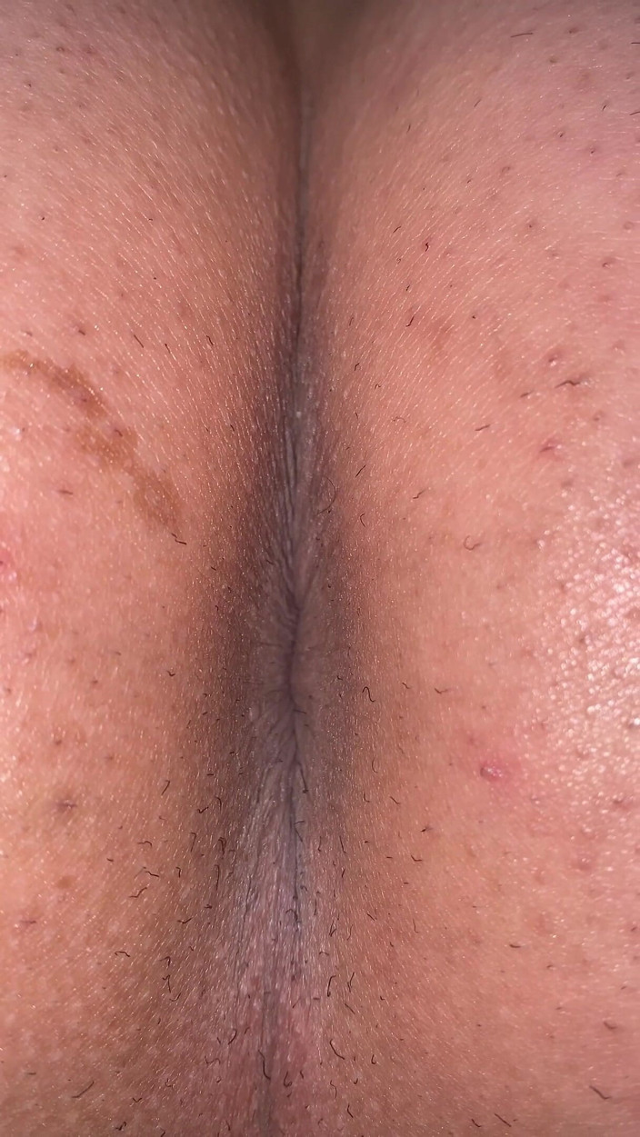 Kyotosigakk: 男がケツの穴を晒す シワがハッキリ見えるように接写