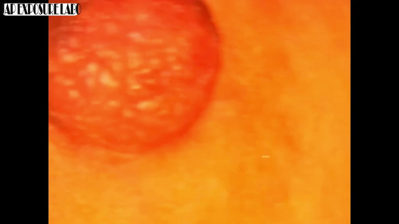 A case of fling: Asian angel 28095