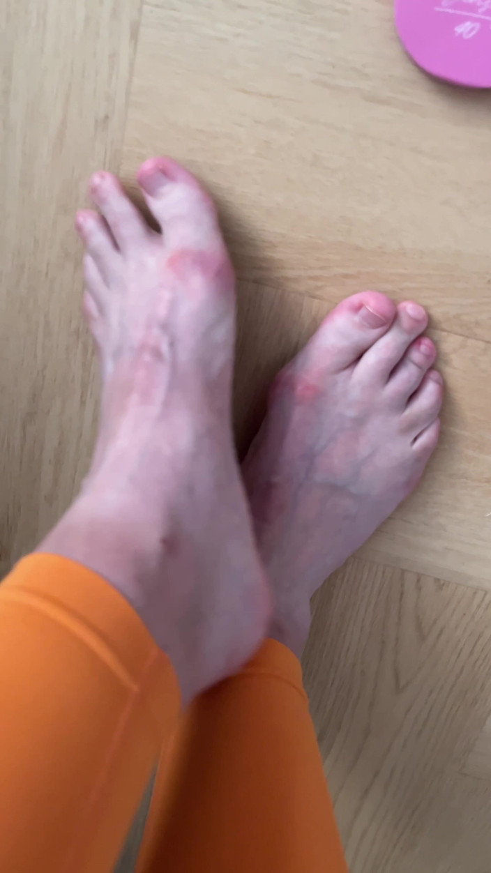 Feet: 人字拖的足部展示