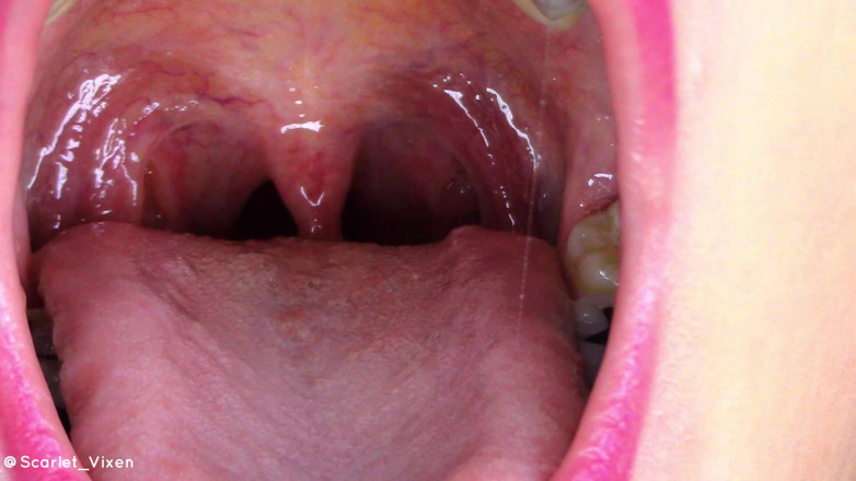 Scarlet Vixen: Uvula flexionando e vibrando