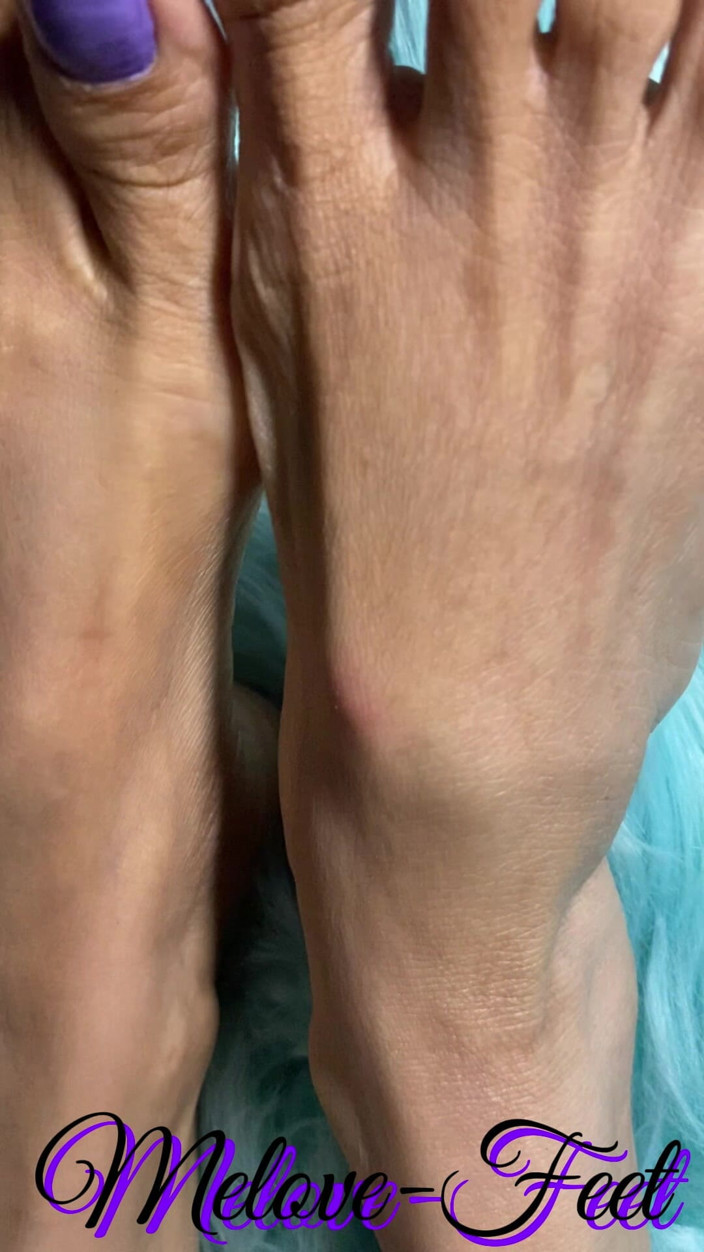 Naelor: Melove právě ukazuje své sexy malé nohy