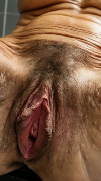 Tipos Vulva - Mujeres Mayores