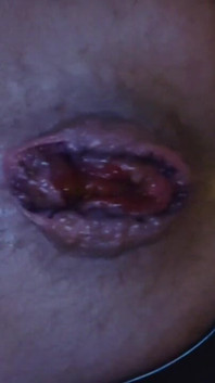 My Hole