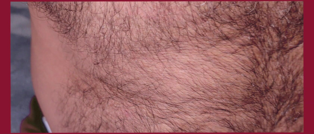 Stink HairyMale: Shades of Red