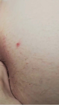 Allison Bloom 2: anal - parte 2 - POV