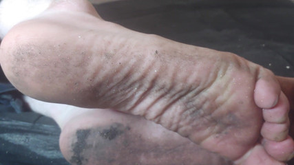 Au79: Nohy byly špinavé