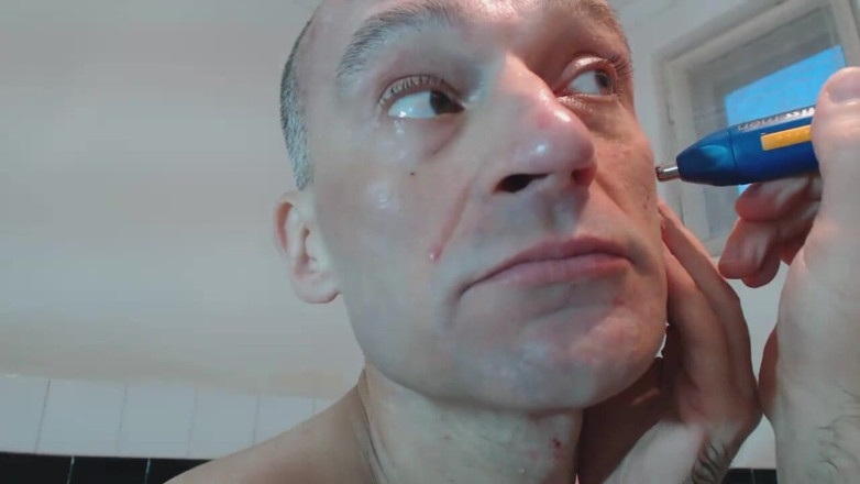 TIVADAR 73: Tivadar 73 нитки видалення.