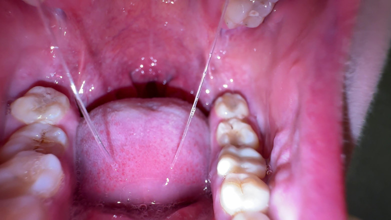 Hottie goddess: Derin gırtlak balçık çıkarma: en iyi salya akıtma ve mukus oyunu