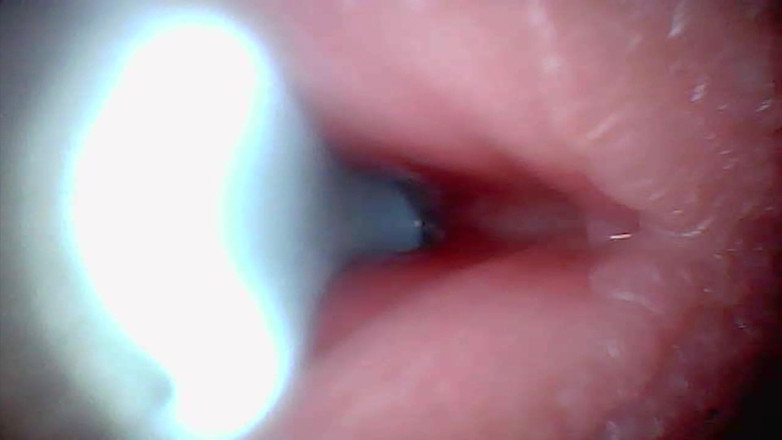 Ladybottox: Endoscope Camera Captures Moment of Male Ejaculation 4K
