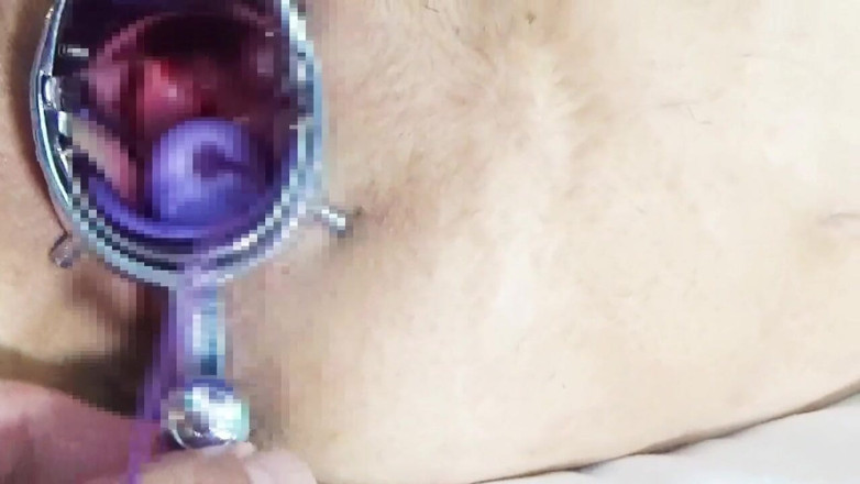 Cattish Brain78: Using a Speculum to Spread an M-woman's Pussy, Anal Training　1/2
