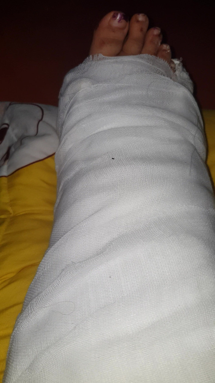 LoraBbw: Wydymanie moich palce w obsadzie