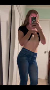 Should This Top Come off?