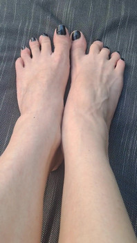 Do We See How Beguiled My Throbbing Foot Veins Are