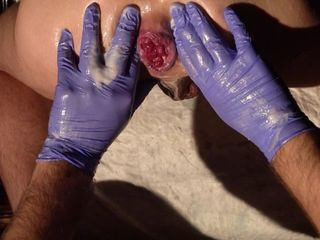 Marcus Pollack Gay: Twinky cute guy shows his rosebutt after punch fisting