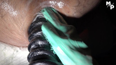 Marcus Pollack Gay: Extrémně roztažený anální kanál