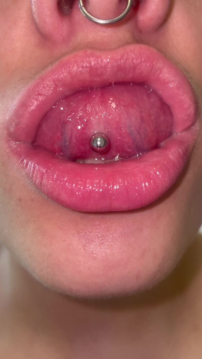 Glitterqueen1999: Mondtour geen make-up tanden tong uvula amandelen controleren