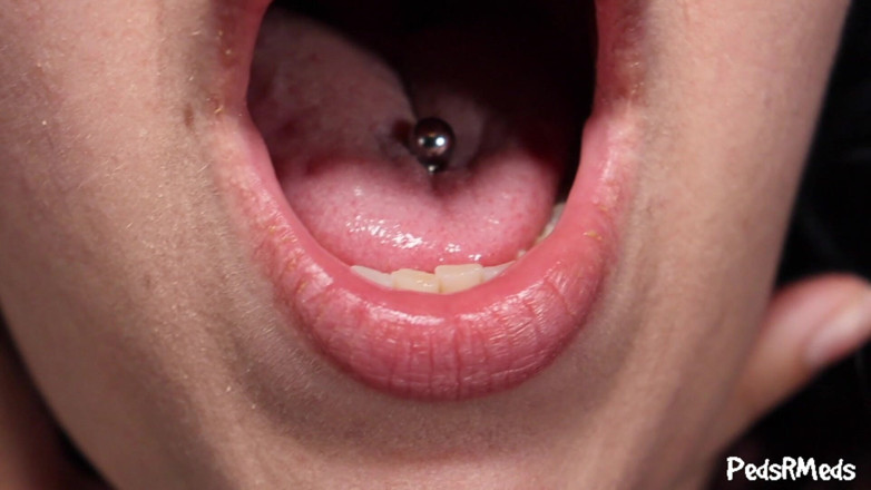 PedsRMeds: Tuffie Somethings Stuck in My Throat
