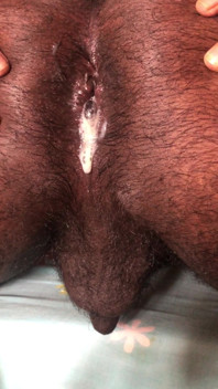 Sri Lankan Ass Cum Dripping