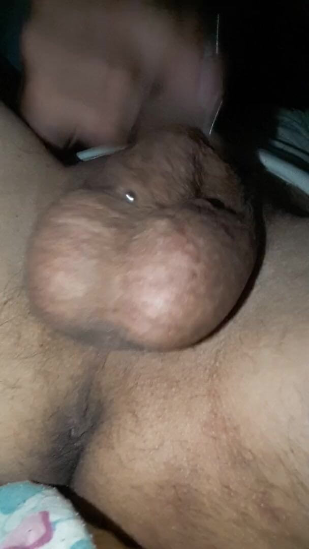 Renoreis: Pengenalan.