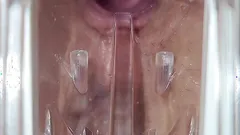 Speculum Cervix Orgasm Cumshot