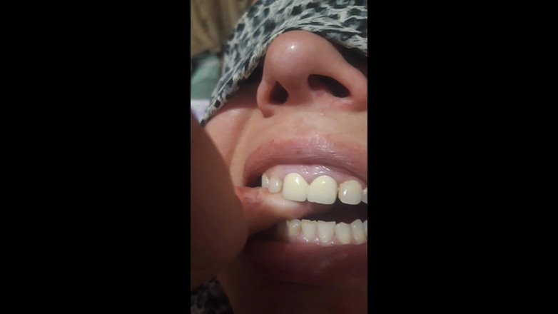 Paultramp: Gigitan jari