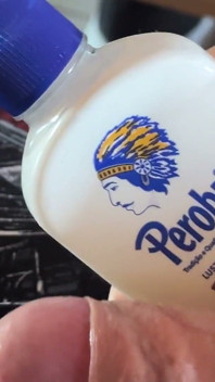 Extreme Ablösung von Phimose mit natürlichem Öl