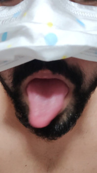 Dickontop