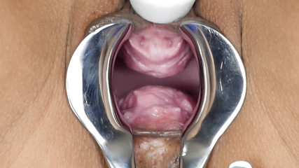 SexyThai1987: Speculum - podívejte se do mě hluboko