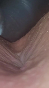 Caping Hole