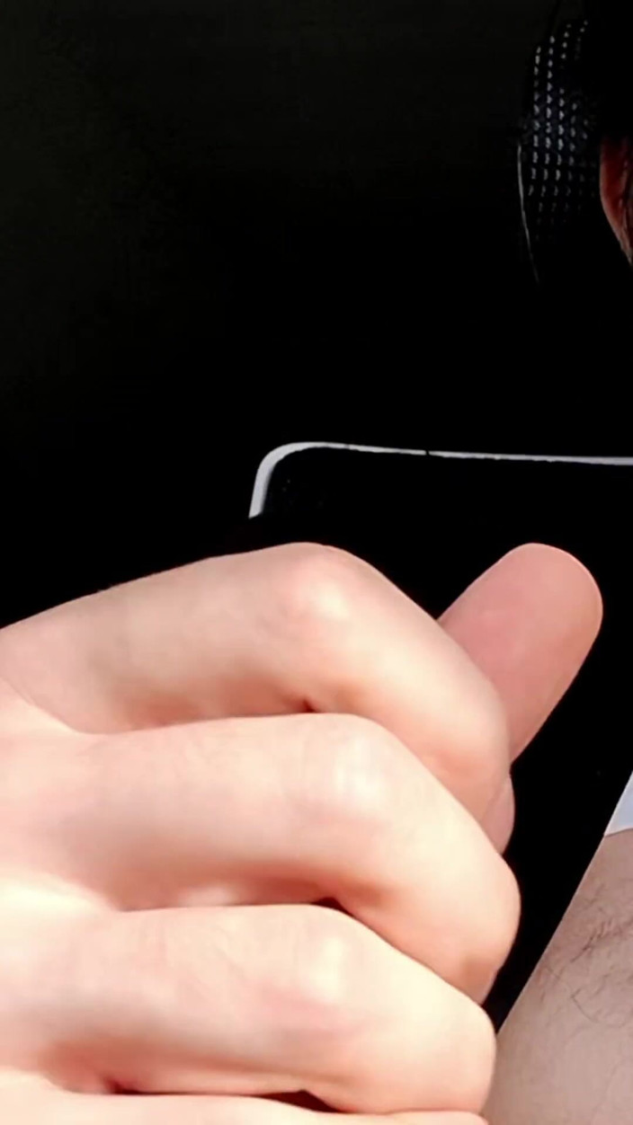 AlbinoAdonis: Up Close