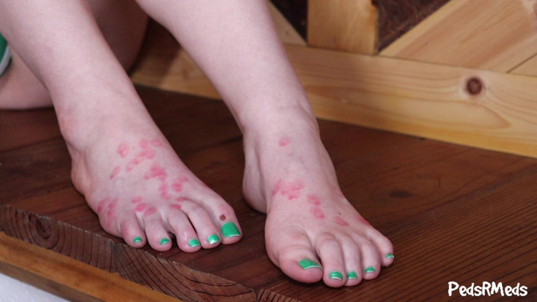 PedsRMeds: Farrah Feet Wax Play