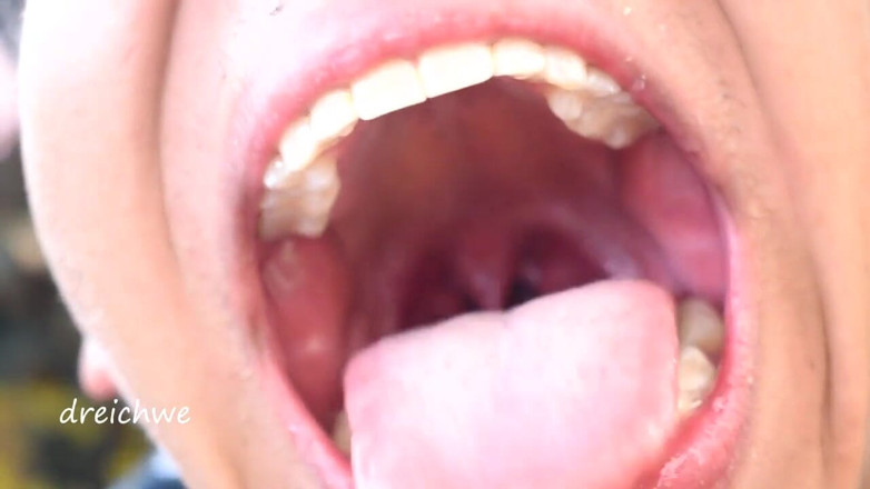 Dreichwe: Haciendo trucos con mi lengua en el jardín