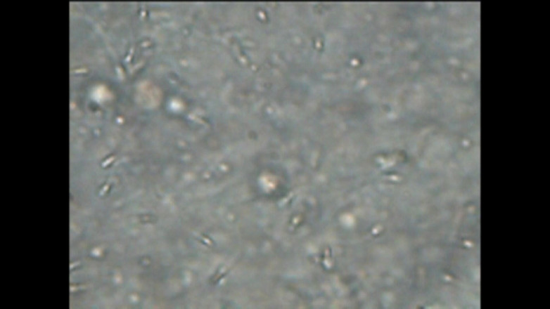 Mark Hannes: Sexdoll Creampie Stand Fuck Masturbation with Sperm Under the Microscope