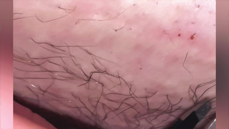 SatisfyingDillyDally: Mich selbst zupfen